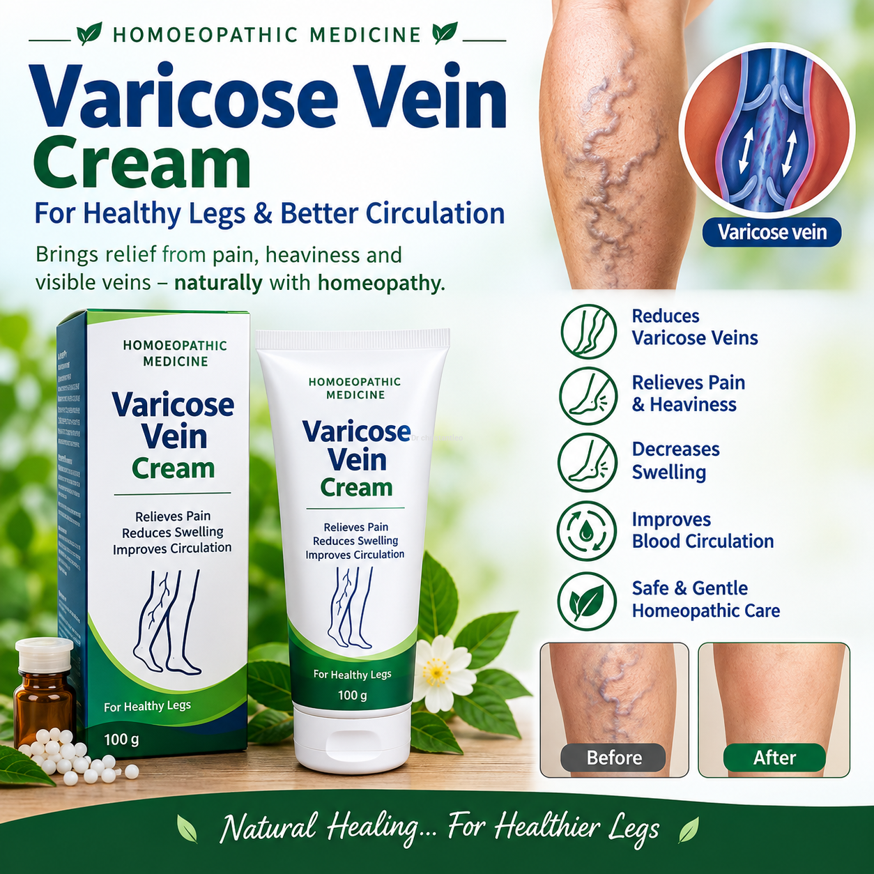 Spl homeopathy Vericose vein cream medicine