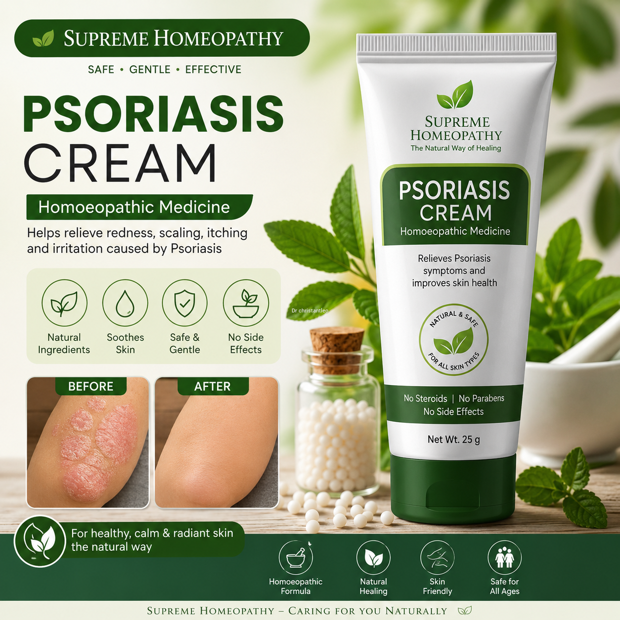 Spl homeopathy Psoriasis cream medicine