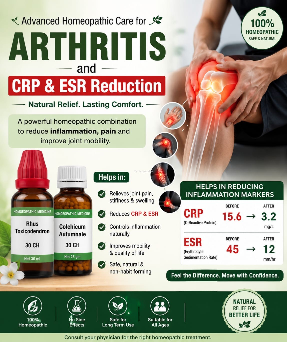 Special Homeopathic medicine for Arthritis and CRP & ESR  Reduction